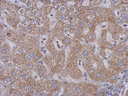 PLCD3 Antibody in Immunohistochemistry (Paraffin) (IHC (P))