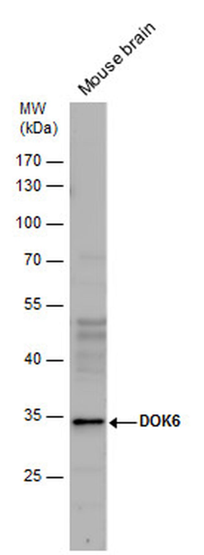 DOK6 Antibody in Western Blot (WB)
