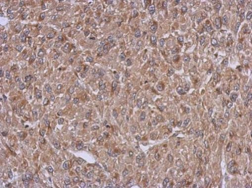 Arfaptin 1 Antibody in Immunohistochemistry (Paraffin) (IHC (P))