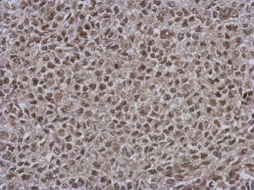DNAJB7 Antibody in Immunohistochemistry (Paraffin) (IHC (P))