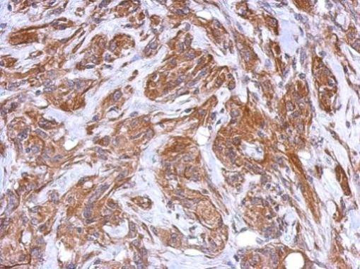 MRVI1 Antibody in Immunohistochemistry (Paraffin) (IHC (P))