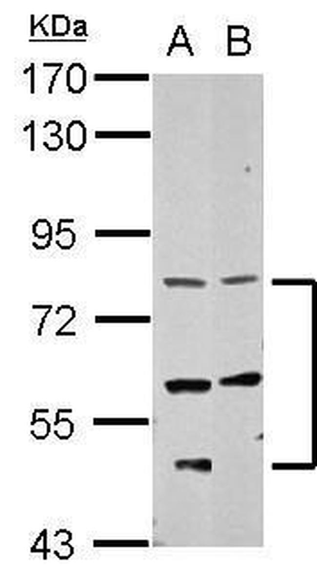 CCDC114 Antibody in Western Blot (WB)