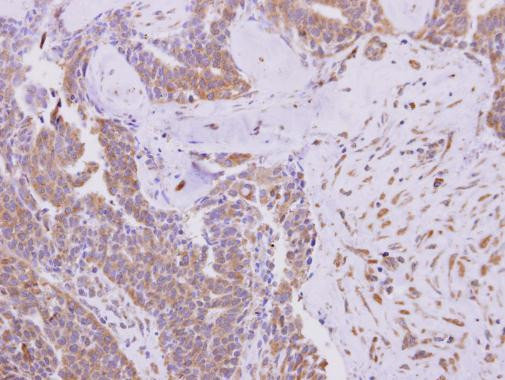 KBTBD3 Antibody in Immunohistochemistry (Paraffin) (IHC (P))