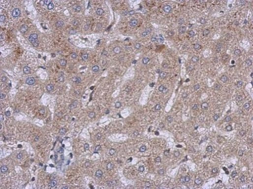 CERCAM Antibody in Immunohistochemistry (Paraffin) (IHC (P))