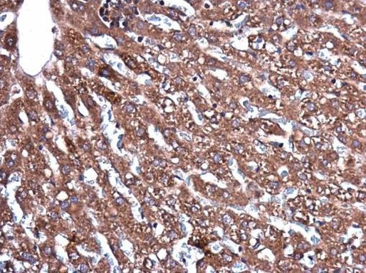 CERCAM Antibody in Immunohistochemistry (Paraffin) (IHC (P))
