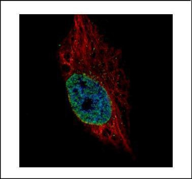 ESRP2 Antibody in Immunocytochemistry (ICC/IF)