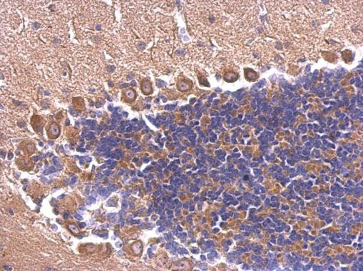 EXOC3 Antibody in Immunohistochemistry (Paraffin) (IHC (P))
