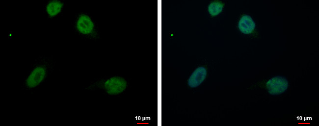 RED Antibody in Immunocytochemistry (ICC/IF)