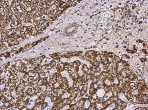 PECI Antibody in Immunohistochemistry (Paraffin) (IHC (P))