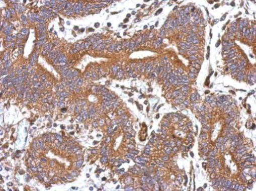 GBAS Antibody in Immunohistochemistry (Paraffin) (IHC (P))