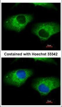 ALDH1A1 Antibody in Immunocytochemistry (ICC/IF)