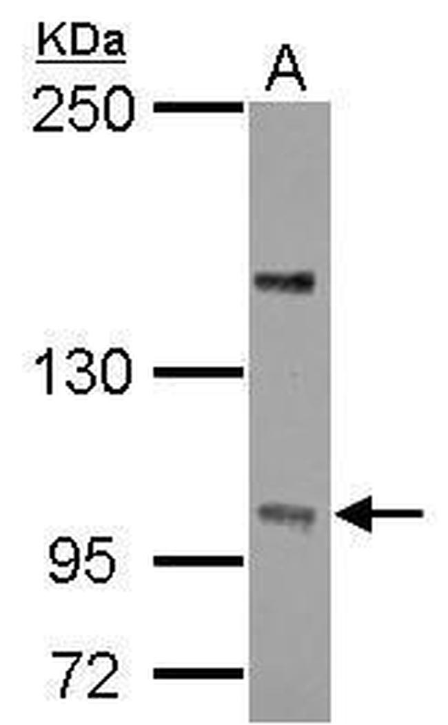 PPP4R4 Antibody in Western Blot (WB)