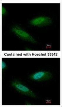 CHD4 Antibody in Immunocytochemistry (ICC/IF)