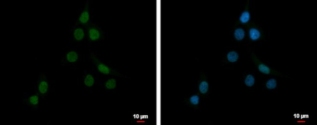 PLAG1 Antibody in Immunocytochemistry (ICC/IF)