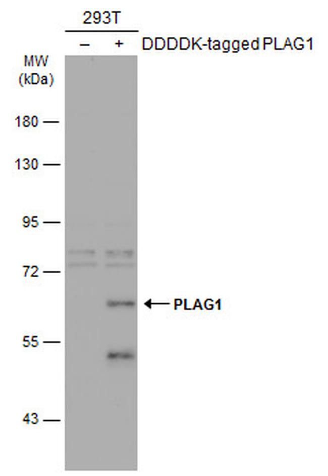 PLAG1 Antibody in Western Blot (WB)