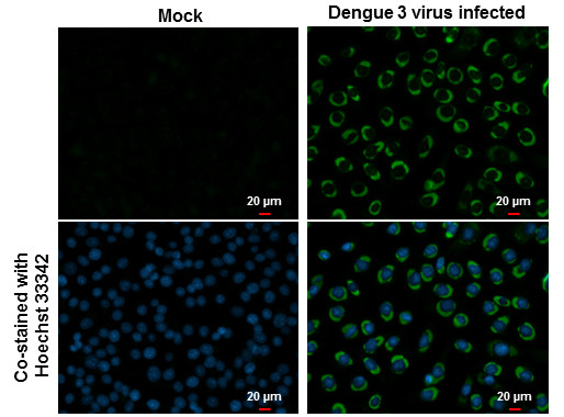 Dengue Virus Type 2 NS2B Antibody in Immunocytochemistry (ICC/IF)