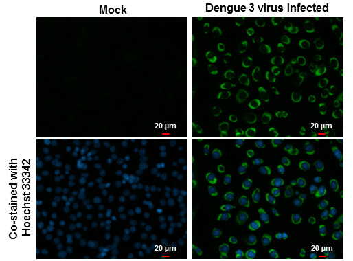 Dengue Virus Type 2 NS4B Antibody in Immunocytochemistry (ICC/IF)