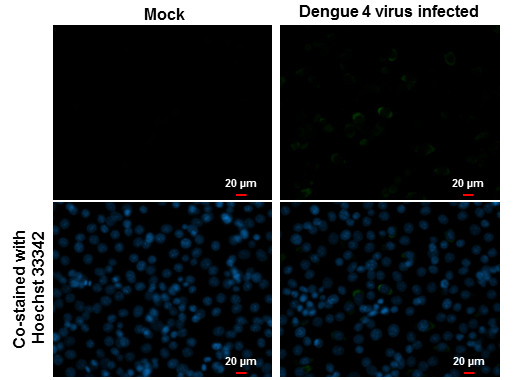 Dengue Virus Type 2 NS3 Antibody in Immunocytochemistry (ICC/IF)
