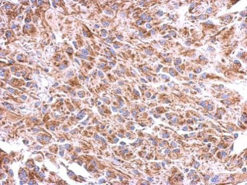 ST8SIA4 Antibody in Immunohistochemistry (Paraffin) (IHC (P))