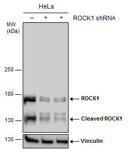 ROCK1 Antibody in Western Blot (WB)