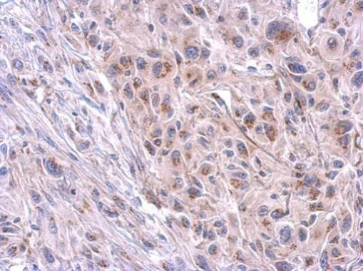 TTC39B Antibody in Immunohistochemistry (Paraffin) (IHC (P))