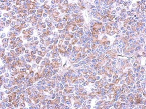 Cyclin I Antibody in Immunohistochemistry (Paraffin) (IHC (P))