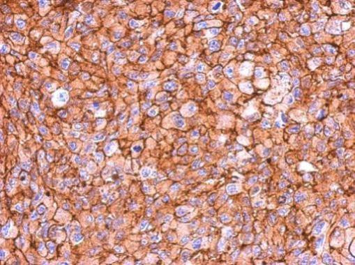 MYO1C Antibody in Immunohistochemistry (Paraffin) (IHC (P))