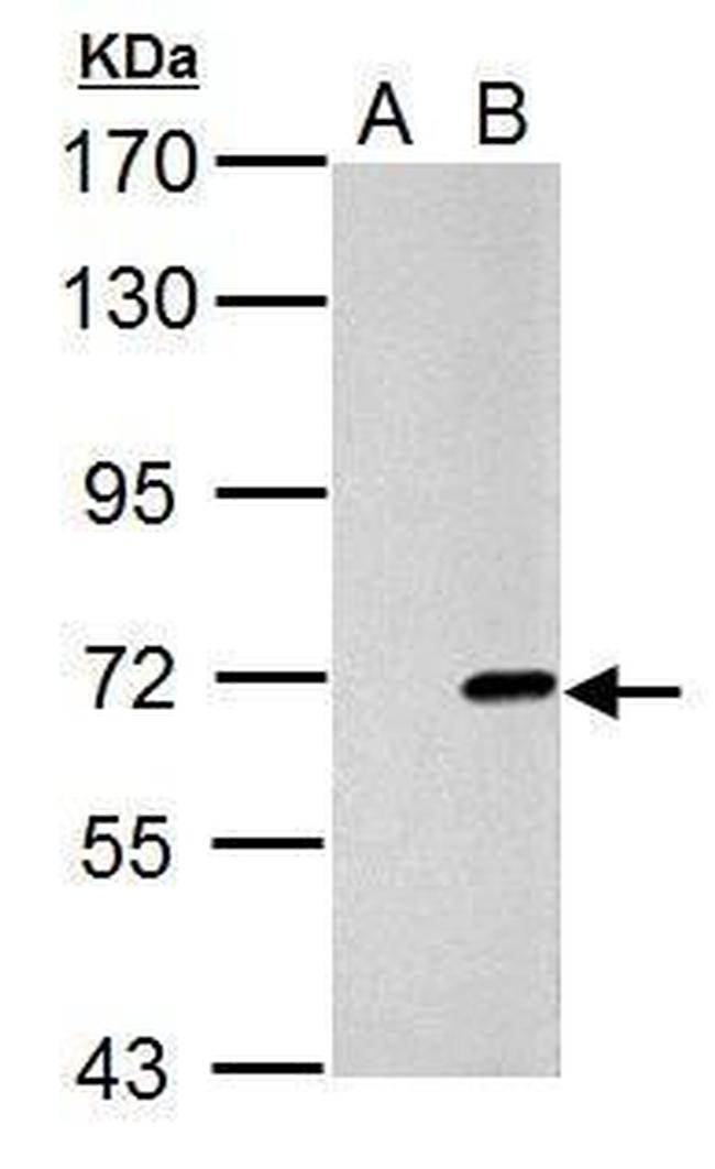 Cre recombinase Antibody in Western Blot (WB)