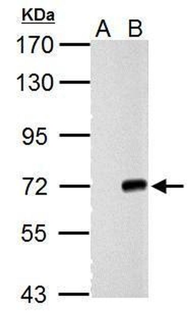Cre recombinase Antibody in Western Blot (WB)