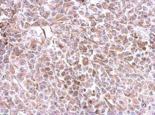 Galectin 9 Antibody in Immunohistochemistry (Paraffin) (IHC (P))