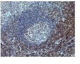 CD7 Antibody in Immunohistochemistry (Paraffin) (IHC (P))