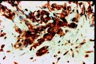 VEGF Receptor 1 Antibody in Immunohistochemistry (Paraffin) (IHC (P))