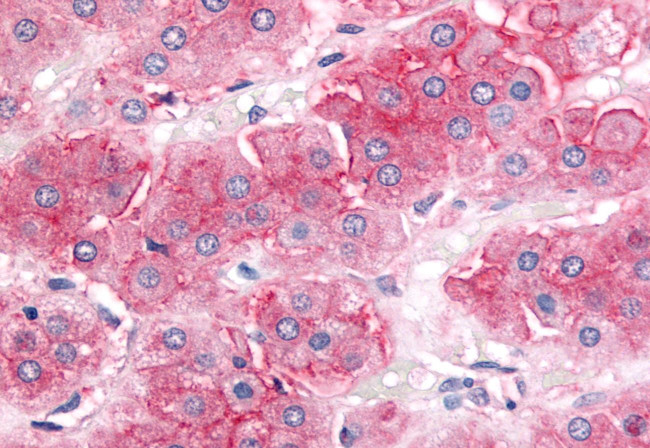 P-Glycoprotein Antibody in Immunohistochemistry (Paraffin) (IHC (P))
