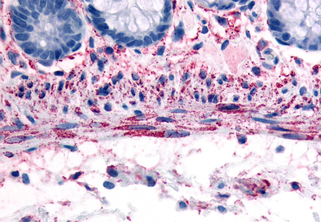 alpha-1b Adrenergic Receptor Antibody in Immunohistochemistry (Paraffin) (IHC (P))