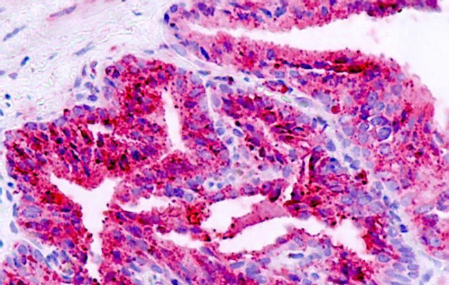 BAI1 Antibody in Immunohistochemistry (Paraffin) (IHC (P))