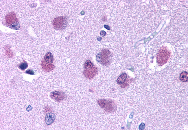 Bombesin Receptor 3 Antibody in Immunohistochemistry (Paraffin) (IHC (P))