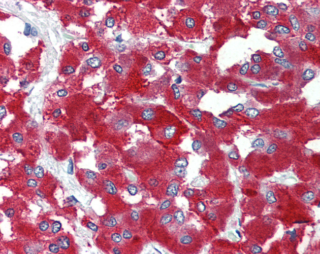 C8orf55 Antibody in Immunohistochemistry (Paraffin) (IHC (P))