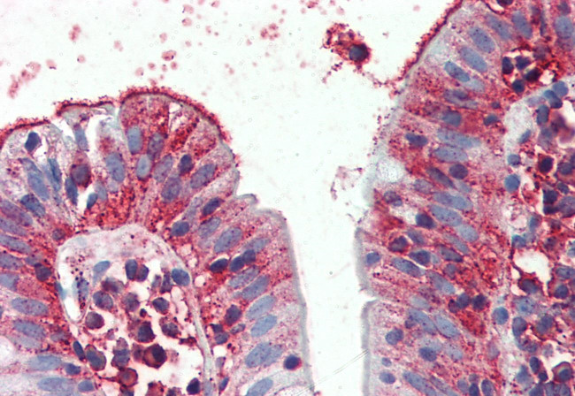 C8orf55 Antibody in Immunohistochemistry (Paraffin) (IHC (P))