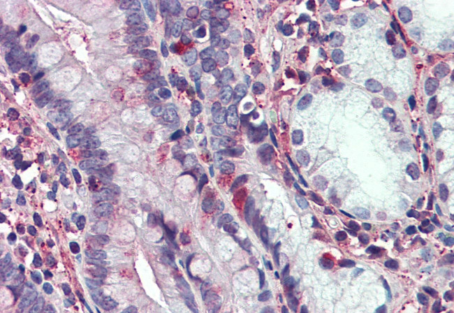 C8orf55 Antibody in Immunohistochemistry (Paraffin) (IHC (P))