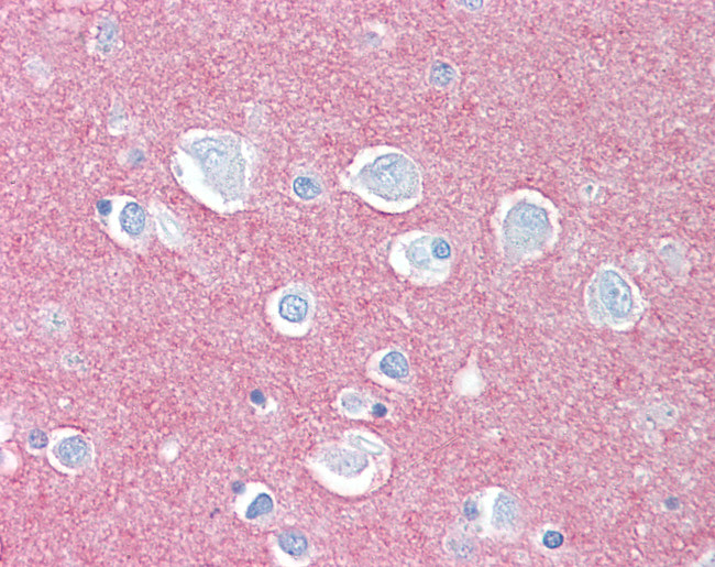 CADM2 Antibody in Immunohistochemistry (Paraffin) (IHC (P))