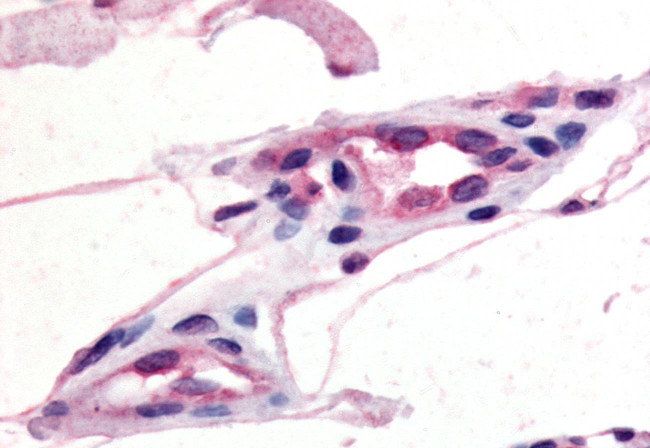 CCR10 Antibody in Immunohistochemistry (Paraffin) (IHC (P))