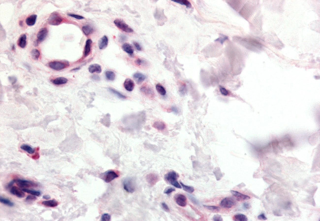 CCR10 Antibody in Immunohistochemistry (Paraffin) (IHC (P))
