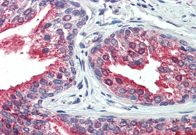 CDCP1 Antibody in Immunohistochemistry (Paraffin) (IHC (P))