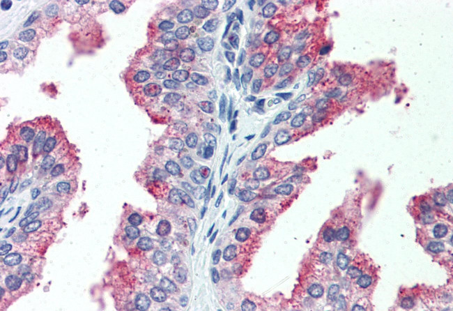 CDCP1 Antibody in Immunohistochemistry (Paraffin) (IHC (P))
