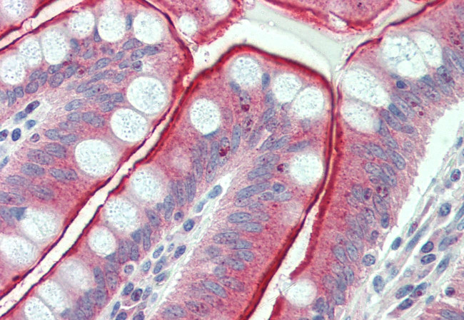 CDHR5 Antibody in Immunohistochemistry (Paraffin) (IHC (P))