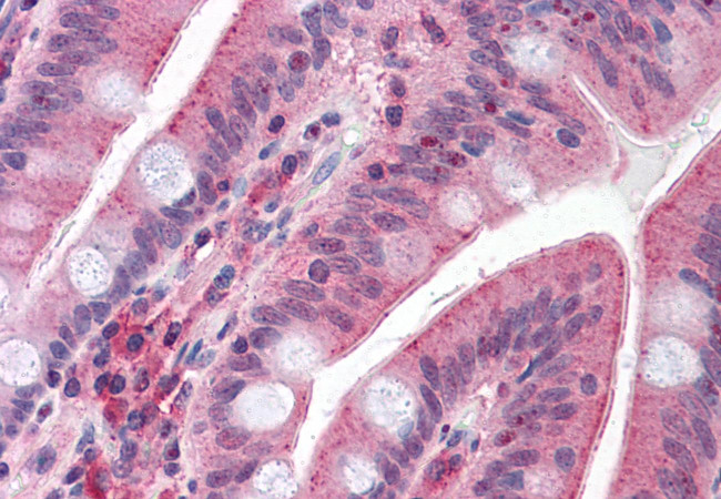 CDHR5 Antibody in Immunohistochemistry (Paraffin) (IHC (P))