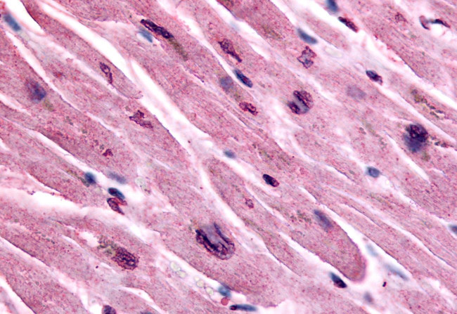 CHRM3 Antibody in Immunohistochemistry (Paraffin) (IHC (P))
