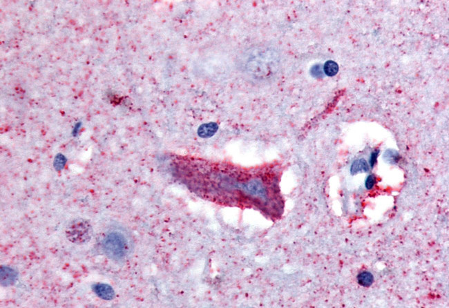 CHRM3 Antibody in Immunohistochemistry (Paraffin) (IHC (P))