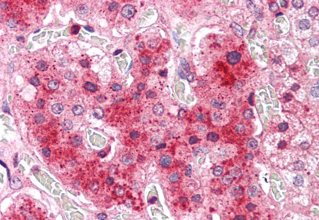 COMT Antibody in Immunohistochemistry (Paraffin) (IHC (P))