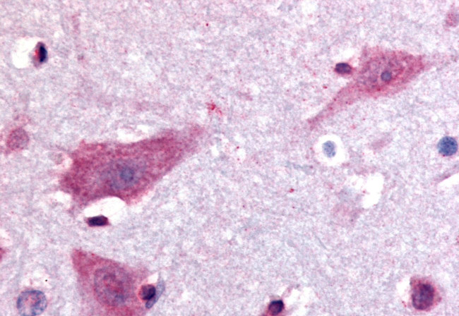 DPP10 Antibody in Immunohistochemistry (Paraffin) (IHC (P))